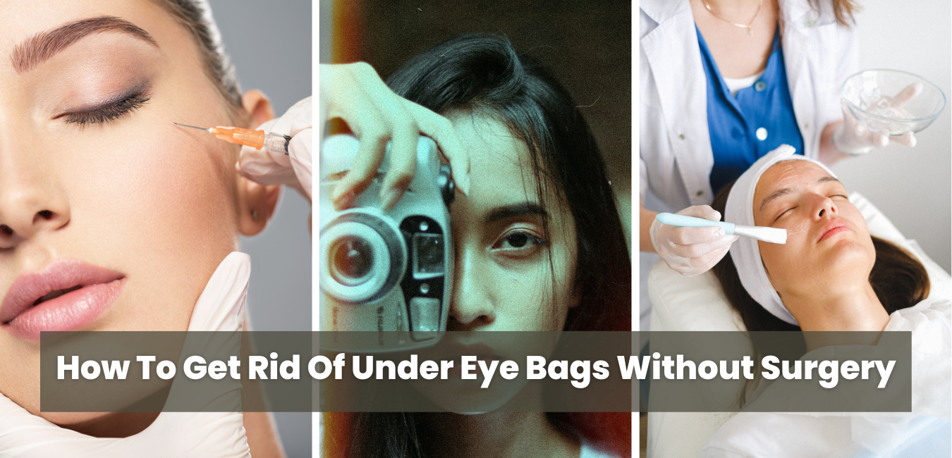Get Rid of The Worst Eye Bags -- Without Surgery!