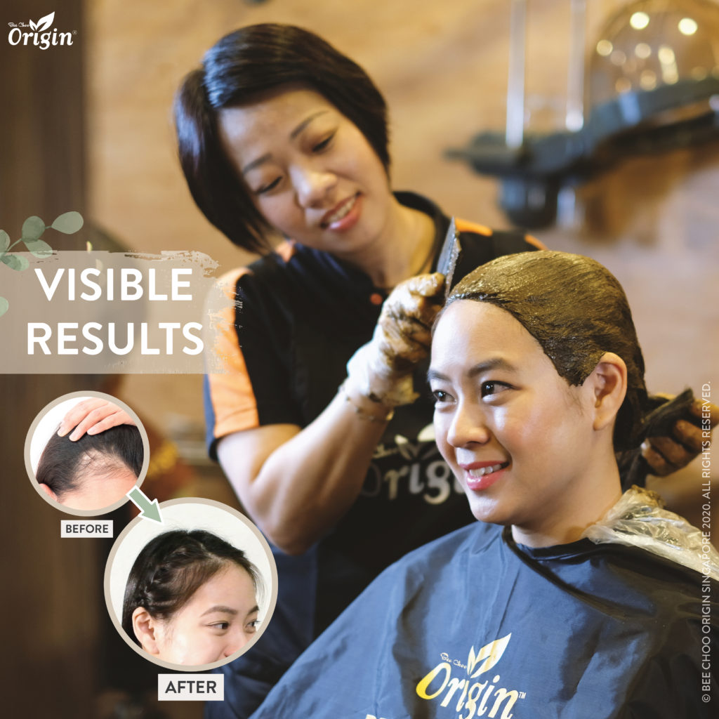 Hair Loss Treatments in Singapore
