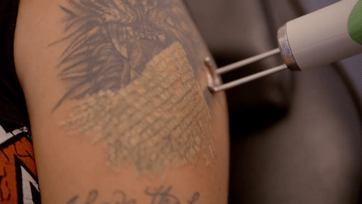 Does Getting A Tattoo Hurt? (Travel Tattoos & Piercings): What It's Like -  Faithfullyours