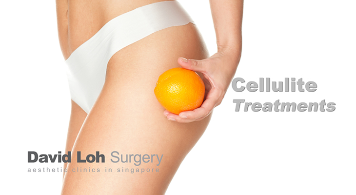 Cellulite Removal in Singapore - Veritas Medical Aesthetics