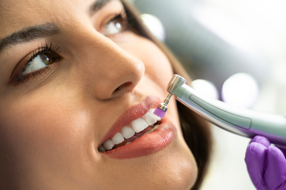 Teeth Polishing In Singapore: What, Where, and How Much?